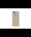 GemTech Xiaomi Uyumlu Mi 5x Mi A1 Kasa Kapak Gold Çıtasız